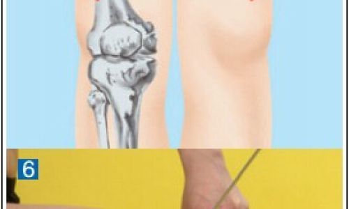 后丘肉在哪个部位